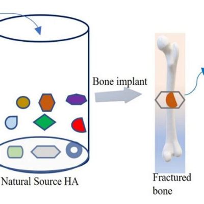  Osteoinduktives Material: Wie Kann Hydroxylapatit Unsere Knochen Heilung Revolutionieren?